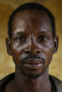 Image result for African American Nose vs African Nose