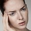 Image result for Migraine with Aura Stroke