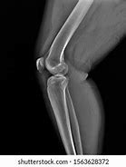 Image result for Normal Lateral Knee Radiograph