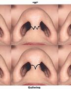 Image result for Columella Septum