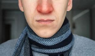 Image result for Red Nose Snot