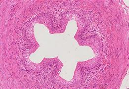 Image result for Ureter Histology Slides Labeled