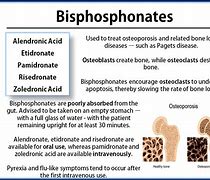 Image result for Bisphosphonate Injection