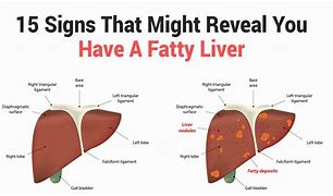 Image result for Liver