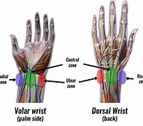 Image result for Outer Wrist Pain