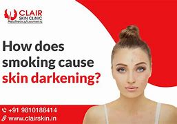 Image result for Skin Darkening