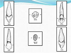 Image result for Maxillary Canine Pulp