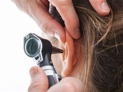 Image result for Removing Eardrum