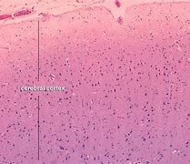 Image result for Brain Tissue Histology