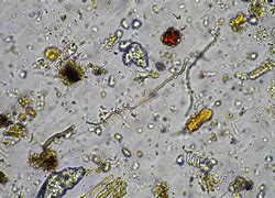 Image result for Fungal Hyphae in Soil