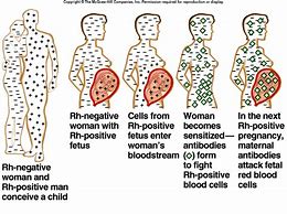 Image result for RH Blood Group System