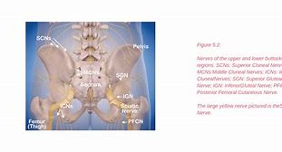 Image result for Buttock Nerves