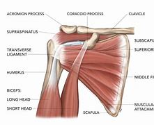 Image result for Supraspinatus and Infraspinatus Tendinopathy