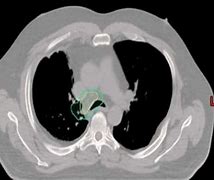 Image result for PPT CT Scan Contrast Timings