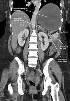 Image result for Abdomen CT Cor