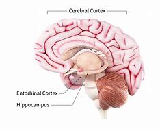 Image result for ALZ Disease