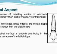 Image result for Maxillary Canine Pulp