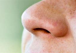 Image result for Mites Living On Face