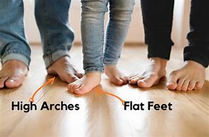 Image result for Foot Arch Images