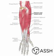 Image result for Extensor Tendons Dorsal Hand