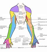 Image result for Brachial Plexus Fall Injury