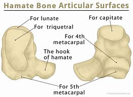 Image result for hamate bone x-ray