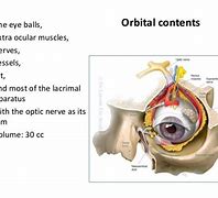 Image result for Orbit Anatomy PPT