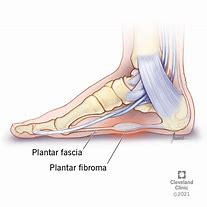 Image result for Plantar Arch