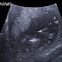 Image result for Baby Sonogram