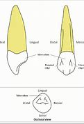 Image result for Maxillary Canine Pulp