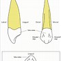 Image result for Maxillary Canine Pulp