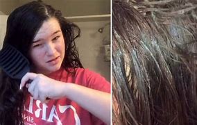 Image result for Gross Back Hair