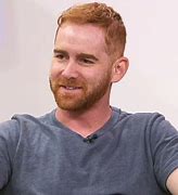 Image result for Andrew Santino Acne