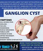 Image result for Ganglion Cyst in Capitate