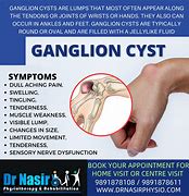 Image result for Cyst On Wrist