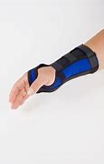 Image result for Pain in Wrist below Thumb