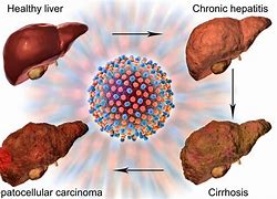 Image result for Liver Blood