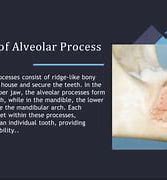 Image result for Alveolar Arches