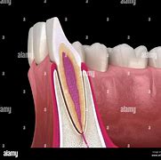 Image result for What Is a Lateral Tooth