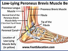 Image result for Peroneus Brevis Attachment