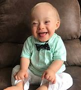 Image result for Down Syndrome Baby Pictures