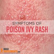 Image result for Poison Ivy Rash Cream