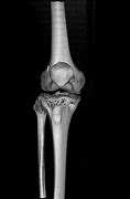 Image result for CT Knee Point Graph