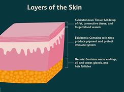 Image result for Dermis Skin Cut