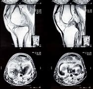 Image result for CT Knee Point Graph