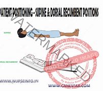 Image result for Dorsal Recumbent Position