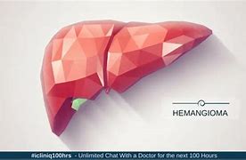 Image result for Hemangioma On Liver