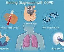 Image result for COPD Pinterest