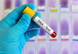 Image result for Free DNA Testing Kits