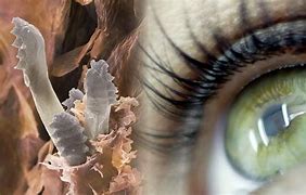 Image result for Human Eyelash Mites